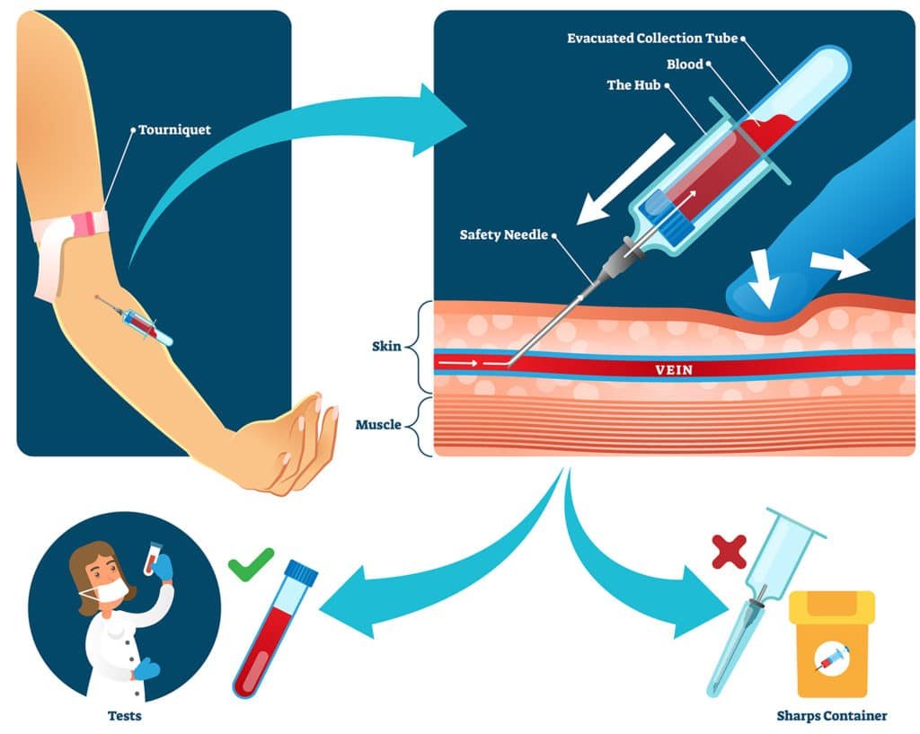 Phlebotomy & Blood Collection Training